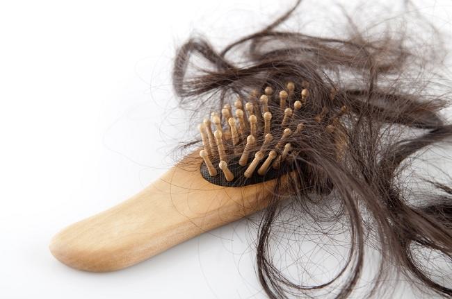 Penyebab Kerontokan Rambut