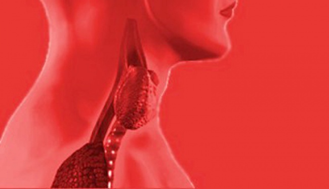 Faktor Risiko dan Siapa yang Paling Rentan