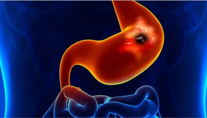 Bagaimana Dokter Menegakkan Diagnosi